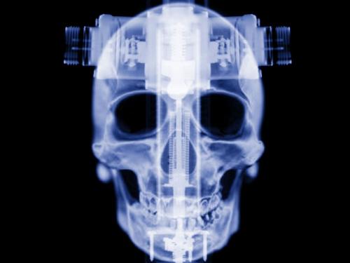 skull, humain brain - skull of human body or depiction of thoughts