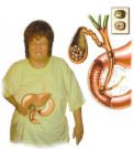 Gallstone - Gallstone problem
