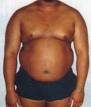 over weight - being over weight