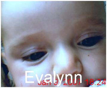evalynn - This is a close up of my 8 month old daughter