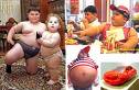 Obesity - Obesity is a condition in which the natural energy reserve, stored in the fatty tissue of humans and other mammals, is increased to a point where it is a risk factor for certain health conditions or increased mortality.
