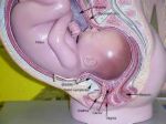 childbirth - The right position of the baby when time to come out.