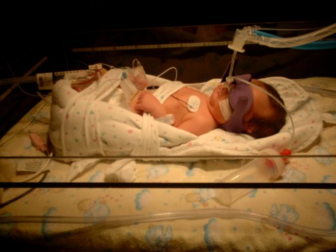 My daughter in NICU - My baby girl sick in the NICU at the Children&#039;s Hospital on the respirator and feeding tube.  