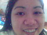 braces - yikes