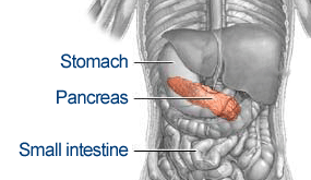 Diabetes - This may be prevented!