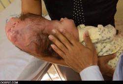 Baby with 2 heads - amazing .. all nature works,,,,