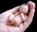 baby fetus - innocents killed