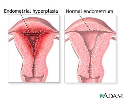 periods - periods/menstruation