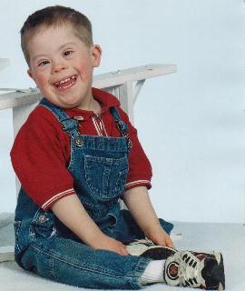 Down Syndrome Child - Down Syndrome child