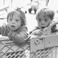 Down Syndrome Children - Down Syndrome Children are people also