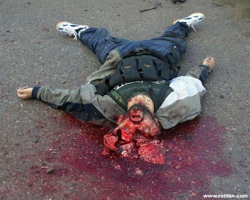 What Should We Do To Free Our Planet From Terroris - This is the real face of Terrorism. In this picture you can see the human bomb who killed by police.