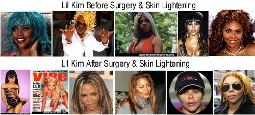 LIL KIMS Transformation  - Lil Kim has gone too far with her surgeries. She looks whiter than ever and her nose looks like Micheal jackons.
