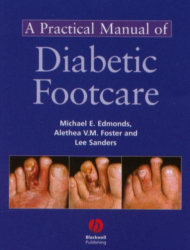 Diabetic foot ailments - Diabetics have so much more to worry about than just their blood sugar.  Be safe and be wise!!