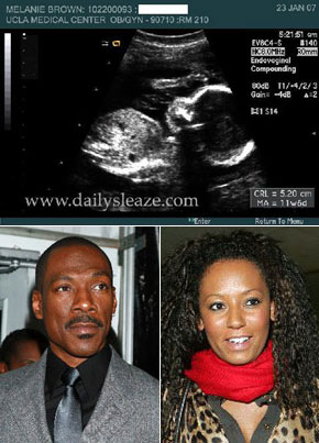 Eddie & Melanie C - Eddie Murphy and Melanie C unborn child Eddie & Melanie C - Eddie Murphy and Melanie C unborn child