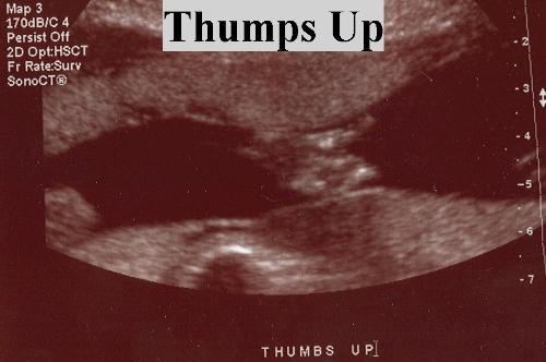 Thumbs up - Thought this was a cute u/s pic of my little one