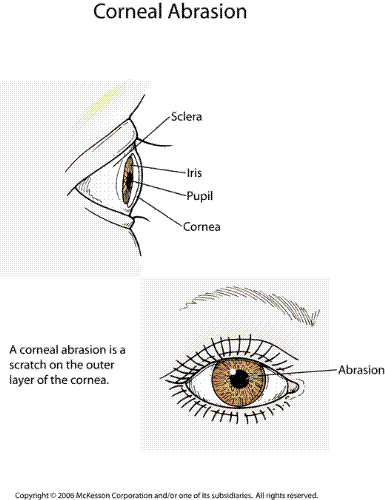 cornabra - cornabra a part in the eye