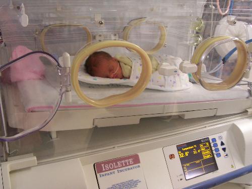Preemie - My daughter after she was born in the incubator.