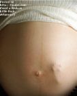 pregnant - a mother's pregnant belly.  you can see the baby's foot print through the mom's belly