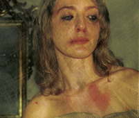 Violence Against Women - A phot showing a woman that was severely beaten