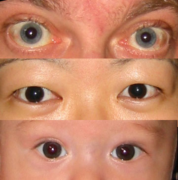 Eyes Galore - what do these eyes say?