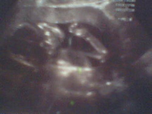 My Little Baby Boy In My Belly - This is just a picture of my little boy Chandler. He is still in my tummy and I cant wait till I get to see him. He is just laying there waving at us all. He loves us.