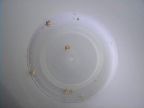 Cystine kidney stones - Just a couple of the hundreds of stones I've passed on my own. I had 4 surgeries for this.