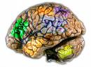 Brain - grain