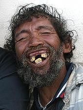 smiling teeth - the sweetest smile.hehee