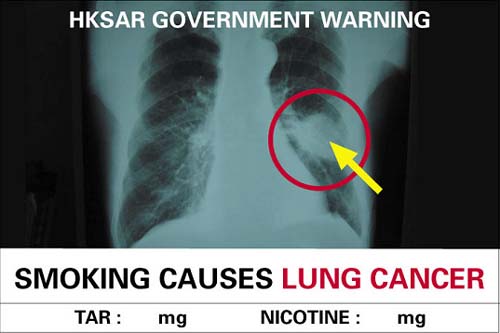 Anti-Smoking - Anti-Smoking advertisment