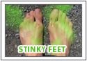 How do you tell someone their feet stinks??What ca - Medical experts say feet odor is caused by:  Athlete's foot  Bacterial foot infection  Fungal foot infection  Normal sweating