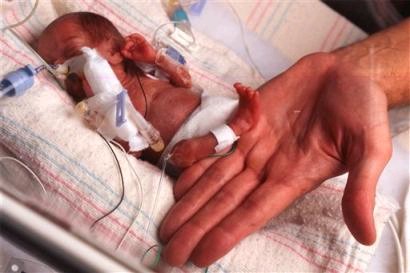 premature baby Dana Lu Blessing - baby