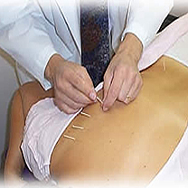 Acupuncture - ancient medical practice