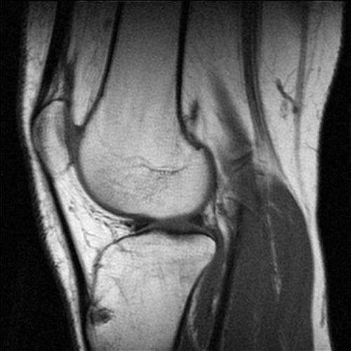 knee - knee radiology