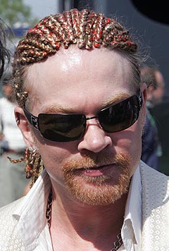 Axl Rose - One of the best vocalists.Member of one of the best bands guns n roses.