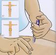 Diabetes - Insulin Shots