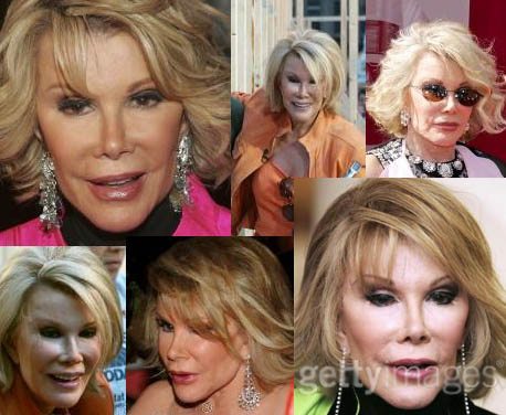 Joan Rivers plastic surgery - Has Joan taken it to far?