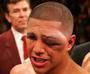 Vargas's face after his last bout ... -  I can't see why people want to beat their faces in ...