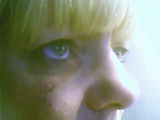 Fall - This is the damage to my Face that I saw kindley inflicted last night lol