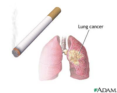 smoking - smoking kills