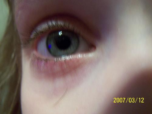 eye shot - This is my daughter real close up.