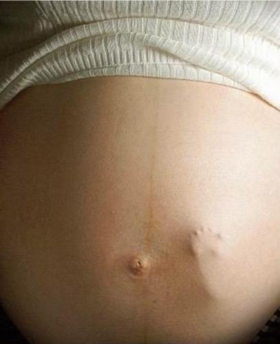 pregnancy,childbirth,woman - picture of pregnant tummy with babies foot pushing outward