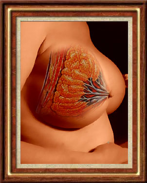 cancer poster - medical illustration