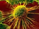 Cancer Cell - Picture of a Cancer cell