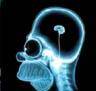microbrain - without brain/with microbrain