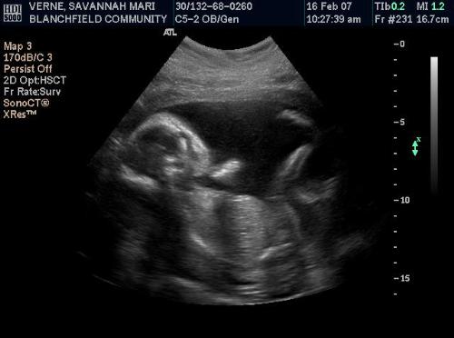 Michael - An ultrasound of my baby Michael!