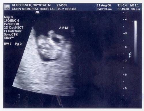 ultrasound - i love ultrasounds they make pregnancy a reality