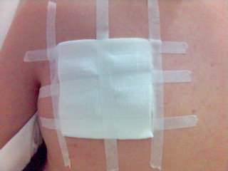 my bed-side operated back - oh it hurts a lot thought im just glad that the operation was over..