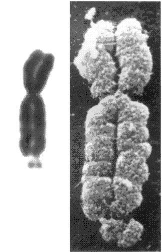 X Chromosome - The X chromosome is in most female mammals. It is said that all men at conception contain the X chromosome, but then they lose a part of it and it becomes a Y and thats what makes us men.