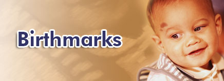 Birthmarks - Do you have any birthmarks
