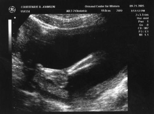 Ultrasound Picture 19 weeks - Leg and foot of baby at 19 weeks gestation.